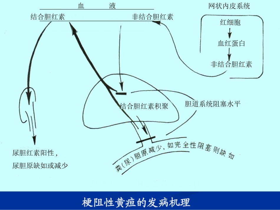 胆汁淤积性疾病_第3页