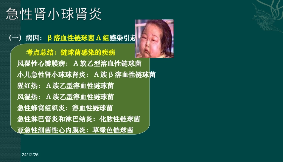 肾小球肾炎病人的护理_第3页