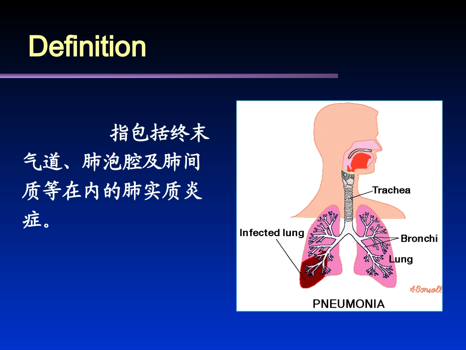 肺部感染性疾病.ppt_第3页