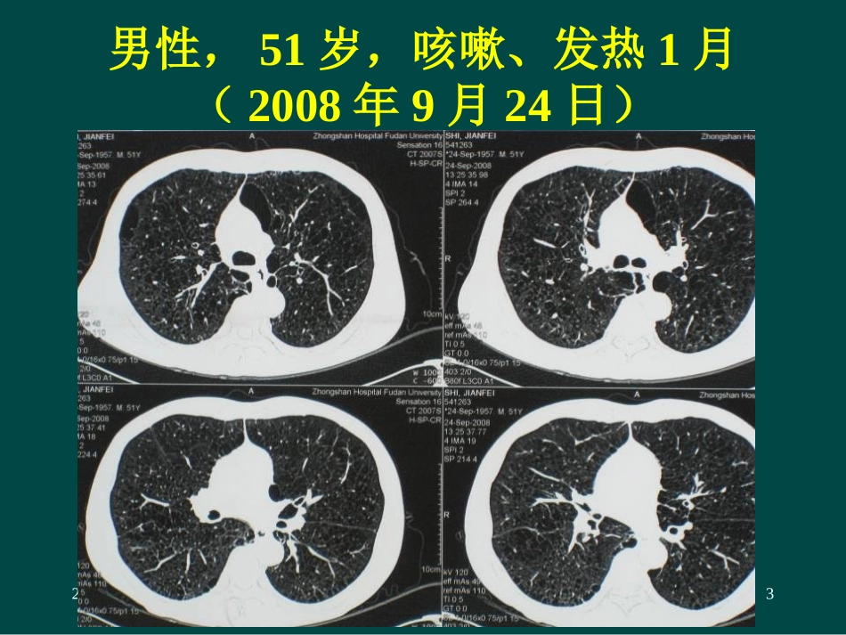 肺真菌感染的诊断进展与治疗疗效_第3页