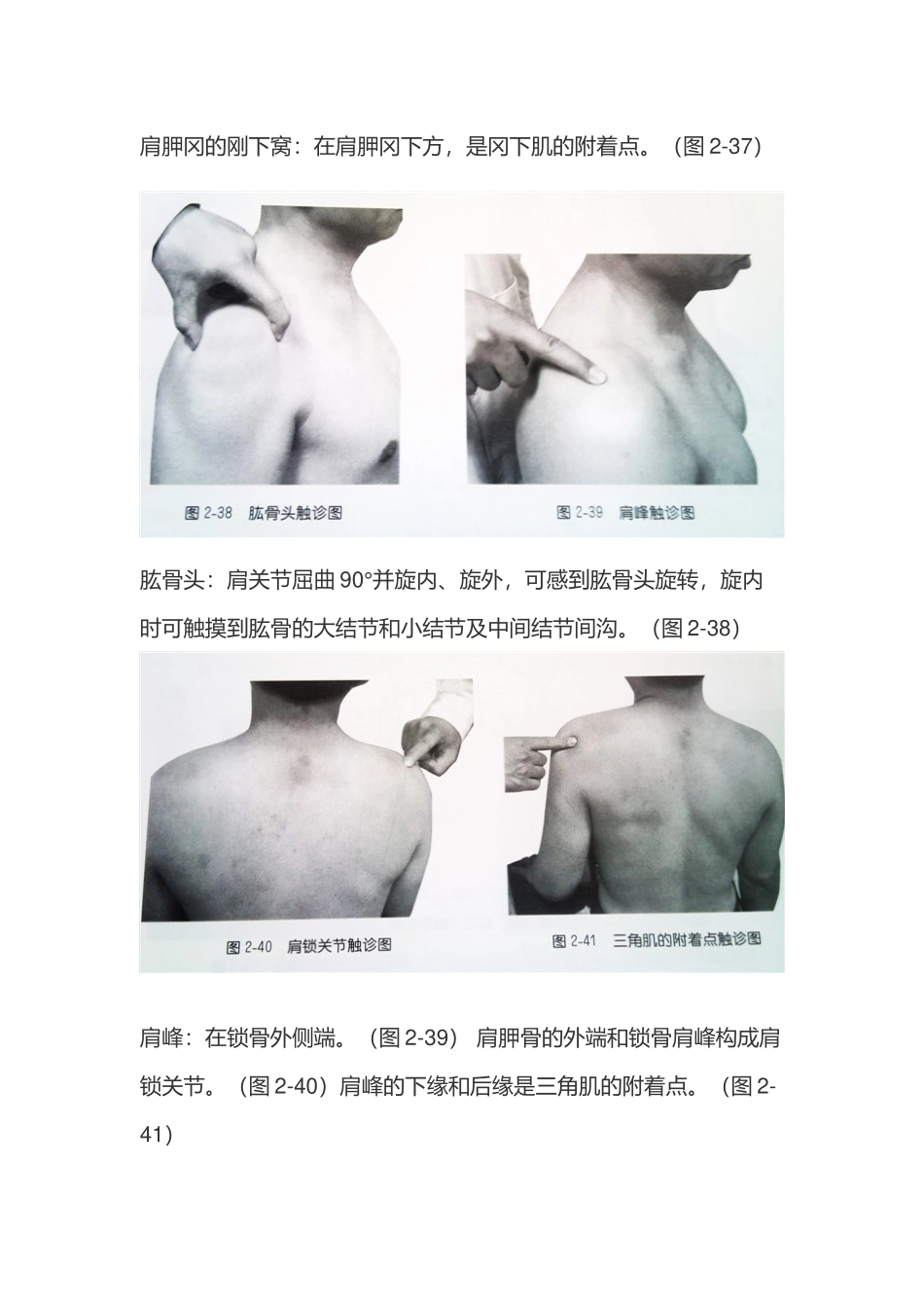 肩部疼痛图解_第2页
