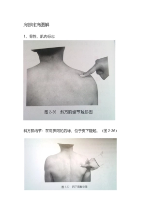 肩部疼痛图解