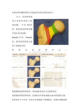 股骨颈骨折闭合或切开复位内固定术