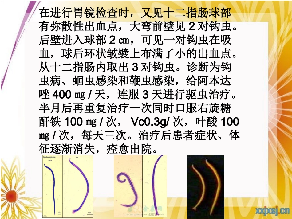 肠道线虫病 ppt_第3页