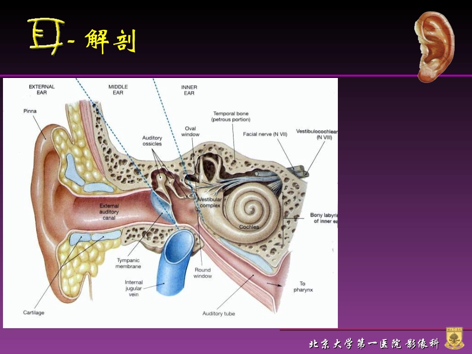 耳的CT解剖_第3页