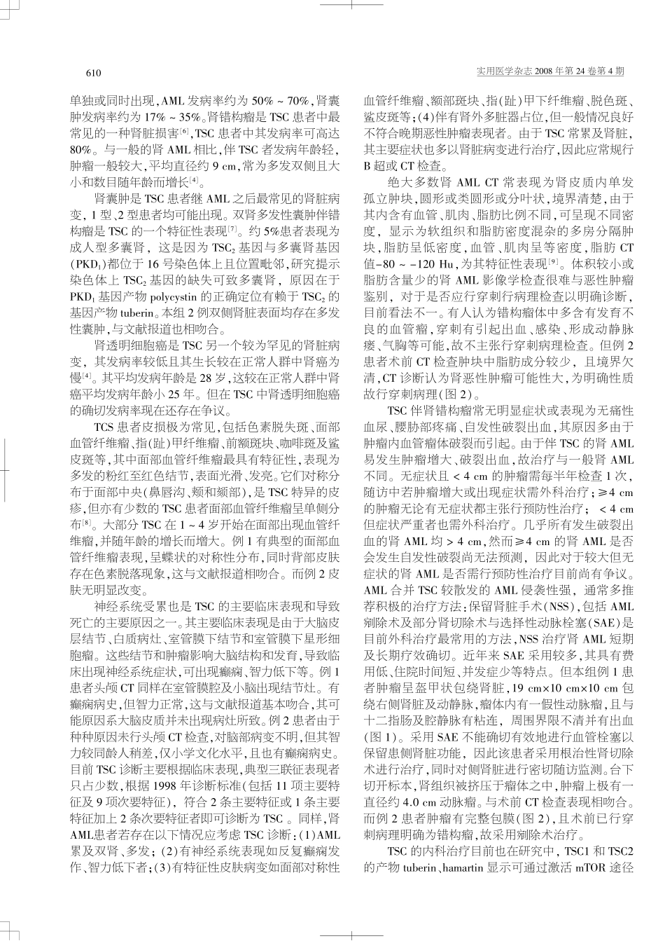 结节性硬化症合并双肾错构瘤诊治并文献复习_第2页