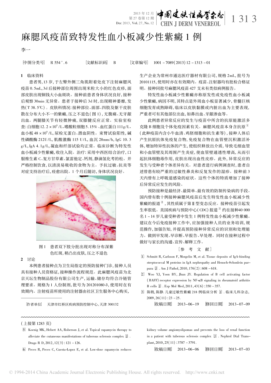 结节性硬化症多系统损害1例_寇晓丽_第3页