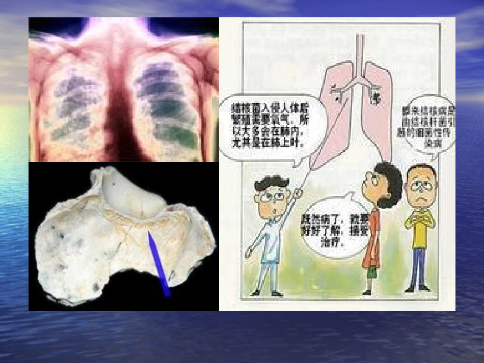 结核菌培养方法、_第3页