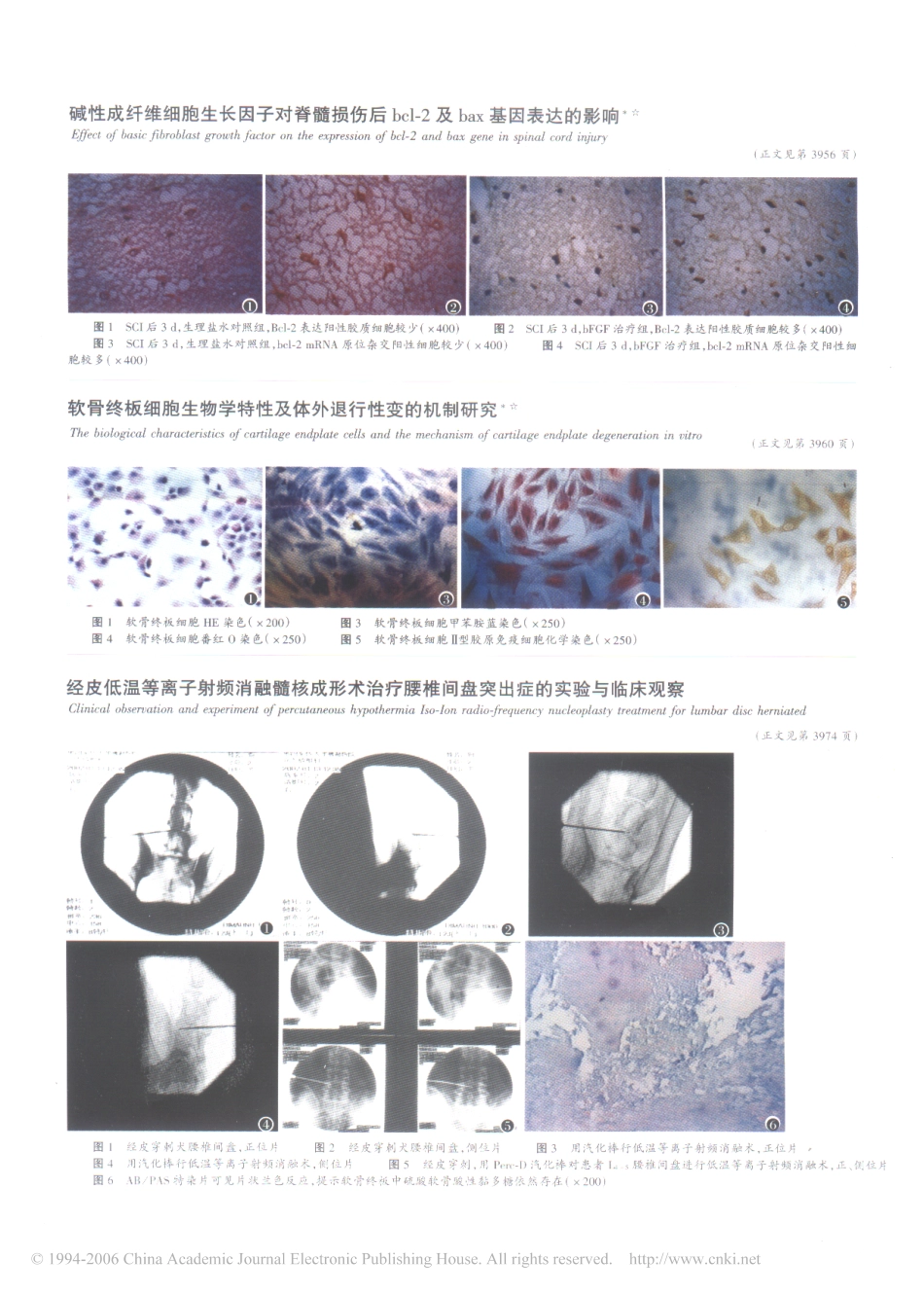 经皮低温等离子射频消融髓核成形术治疗腰椎间盘突出症的实验与临床观察_第3页