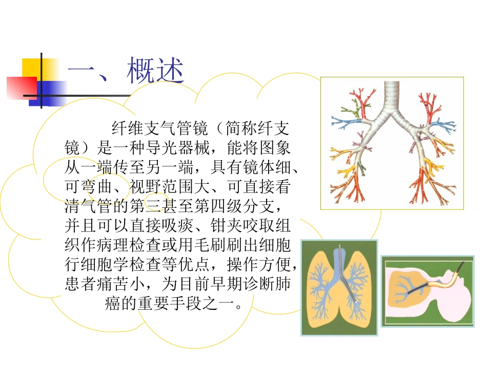 纤维支气管镜检查的注意事项_第3页
