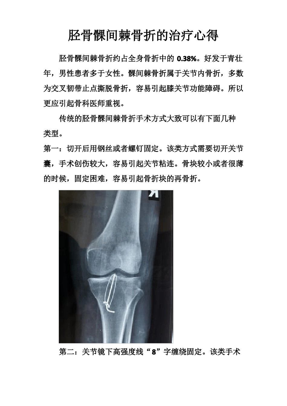 胫骨髁间脊骨折_第1页
