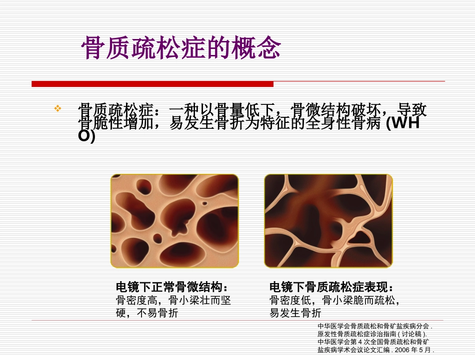 糖皮质激素性骨质疏松症的诊治进展(GIO_第3页