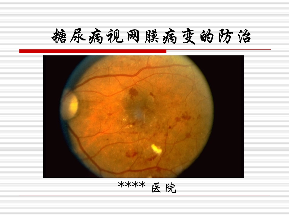糖尿病视网膜病变宣教[1]_第1页