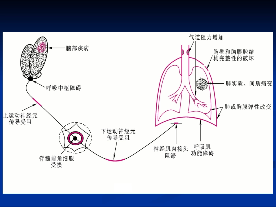 第十三章 呼吸衰竭。赵明-护理学_第3页