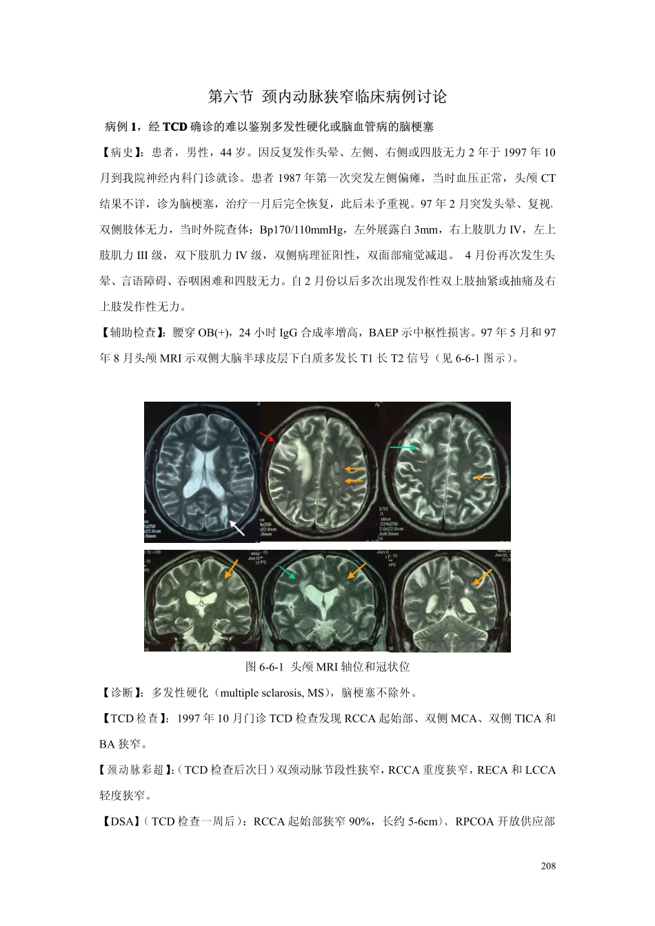 第六章 第六节颈内动脉狭窄临床病例讨论1_第1页