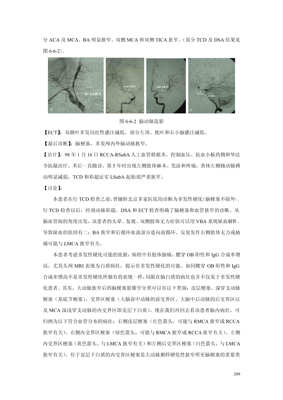 第六章 第六节颈内动脉狭窄临床病例讨论1_第2页