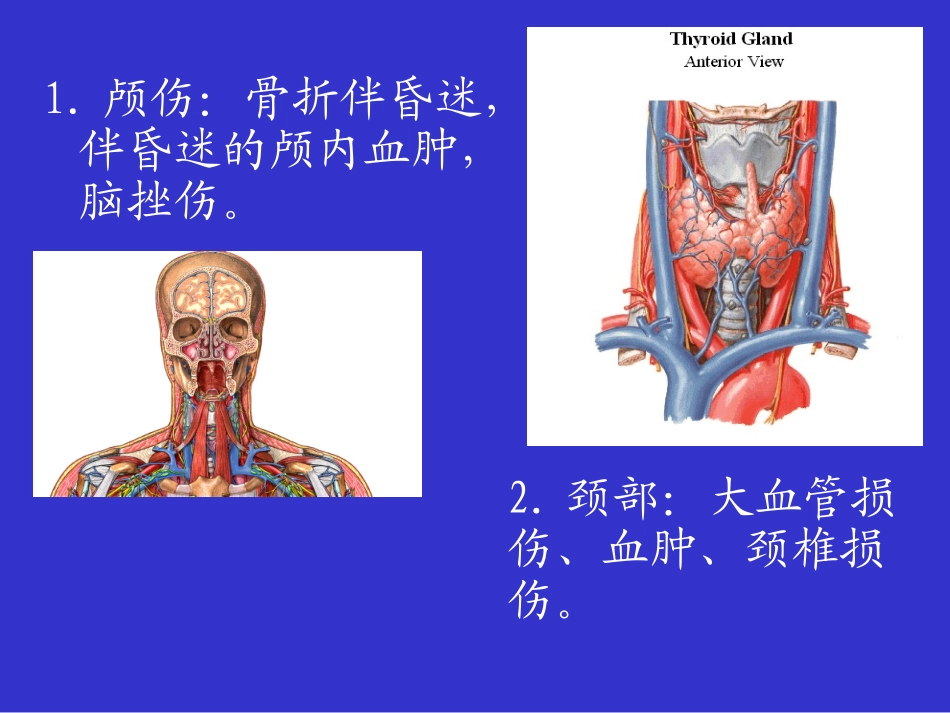 第五章多发伤急救_第2页