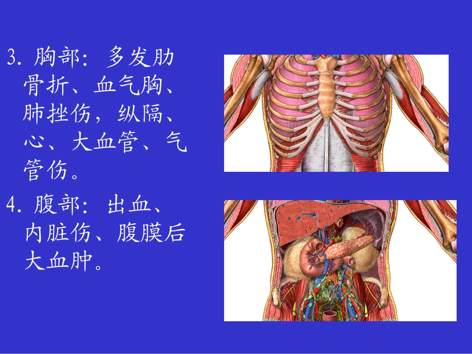 第五章多发伤急救_第3页