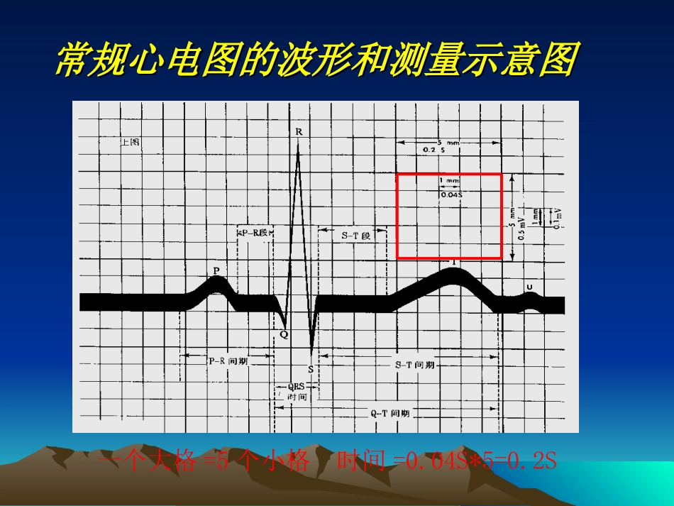 第二节 心电图的测量和正常数据_第3页