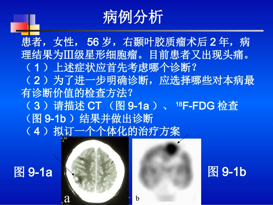 第九章 神经系统_第2页