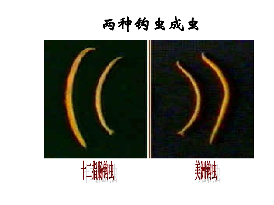 第三讲 钩虫、鞭虫_第3页