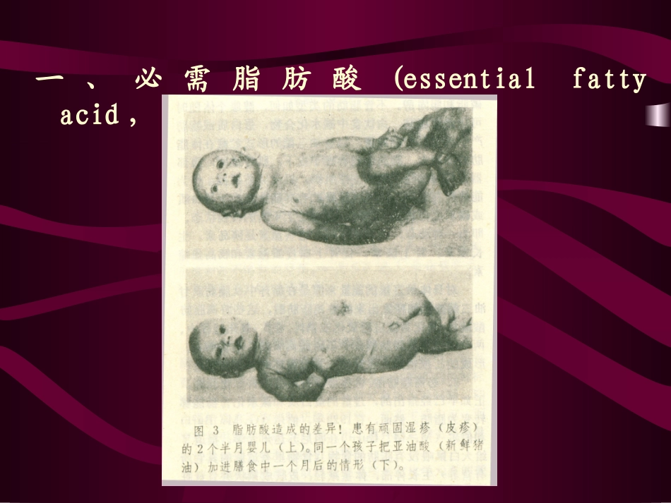 第三节 膳食脂肪_第2页