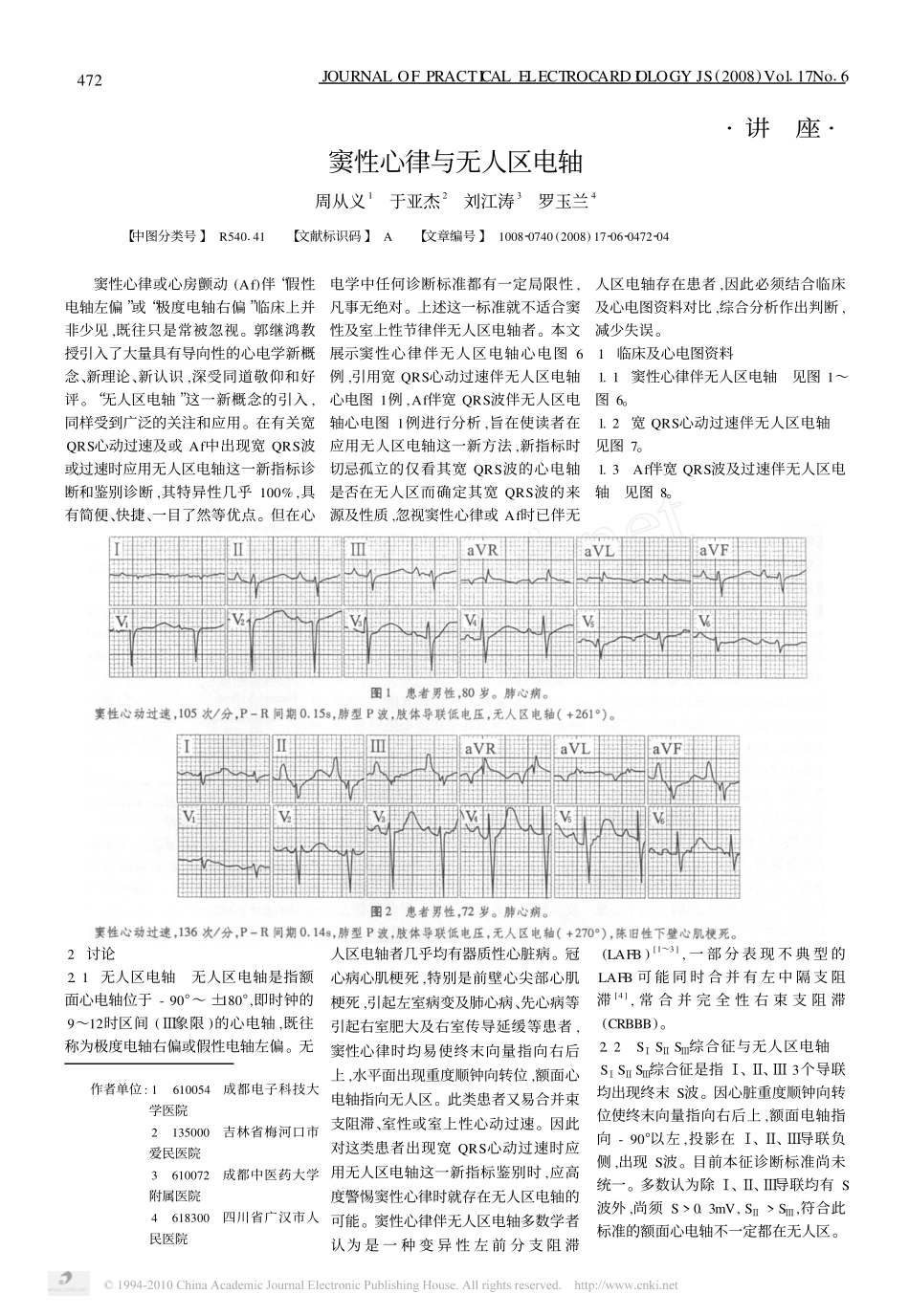 窦性心律与无人区电轴_第1页