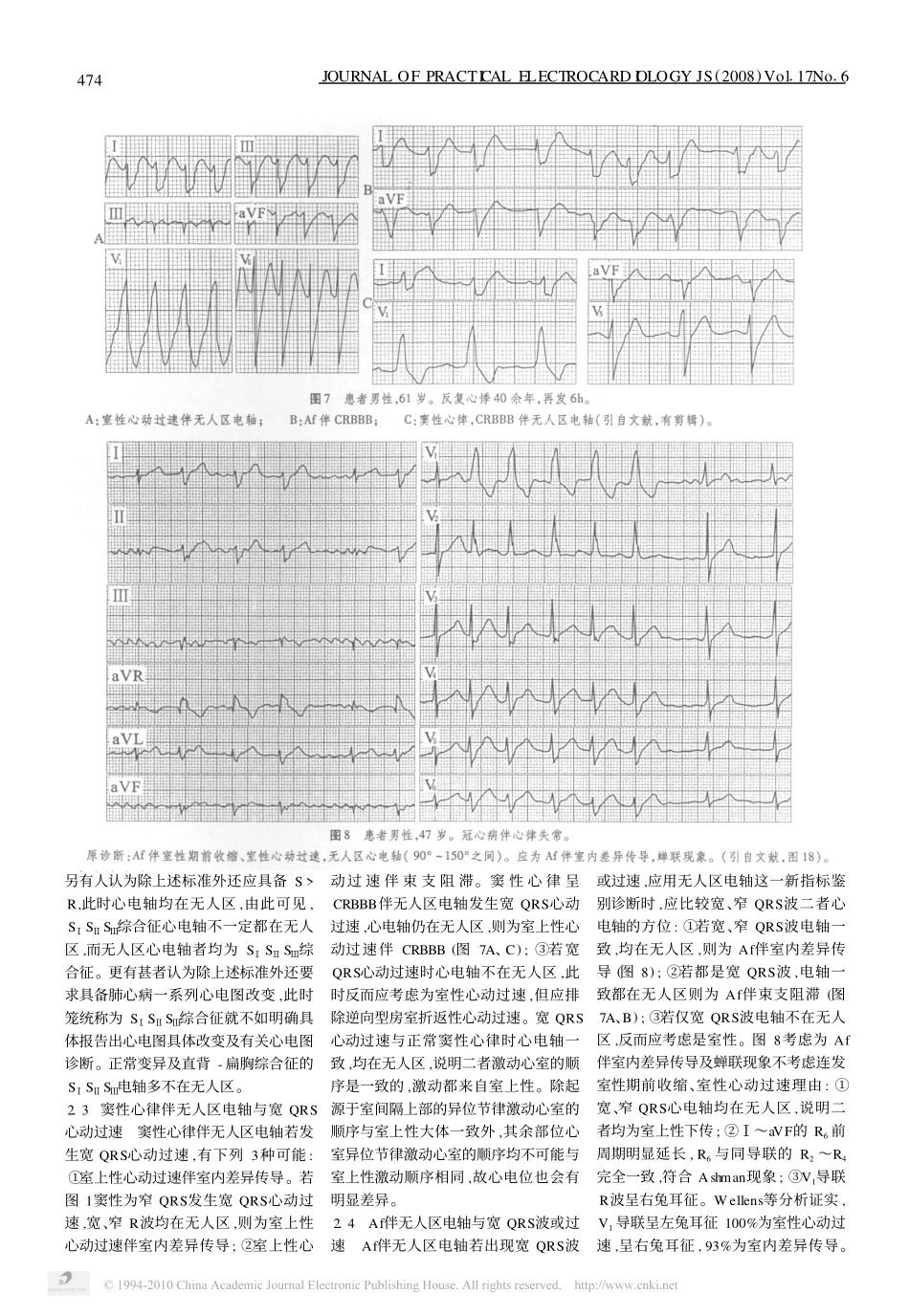 窦性心律与无人区电轴_第3页