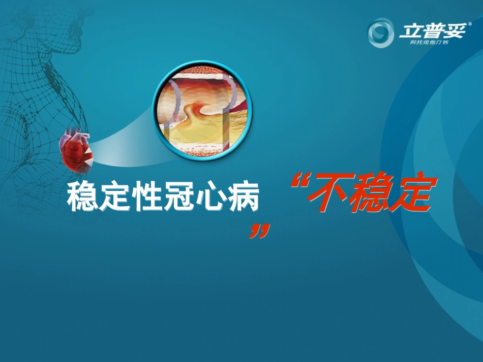 稳定性冠心病不稳定PIM_第1页