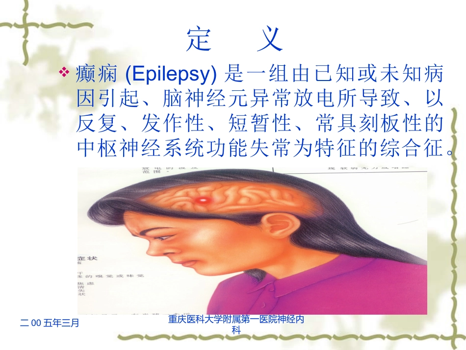 科内进修生讲稿癫痫-2006_第2页