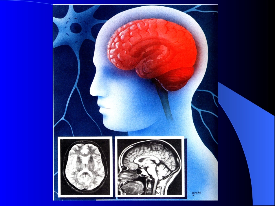 神经系统感染性疾病_第2页