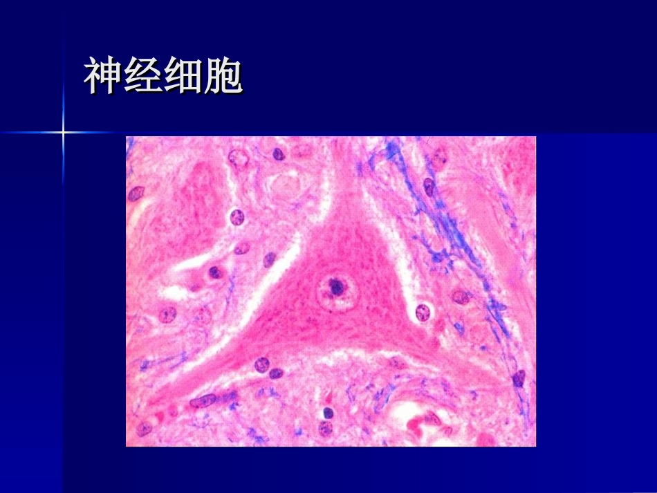 神经系统疾病--带图_第2页