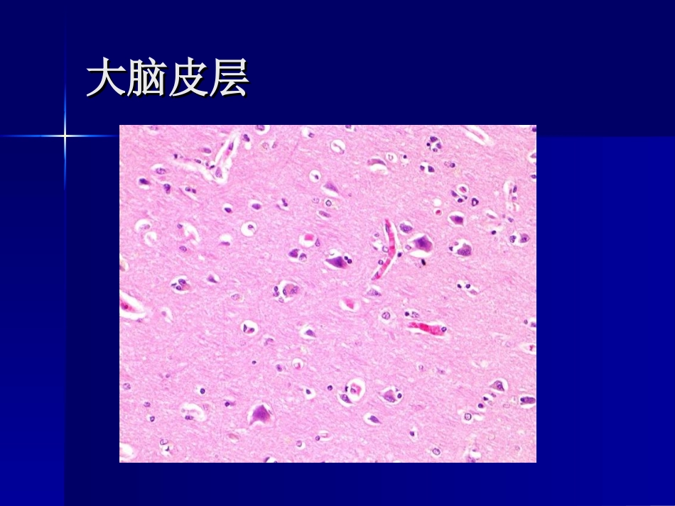 神经系统疾病--带图_第3页