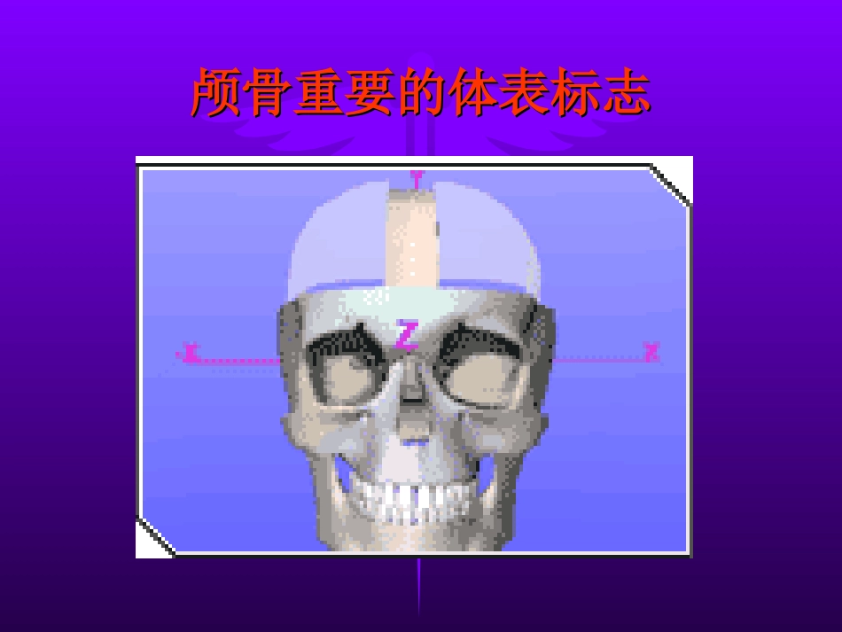 神经外科手术定位_第3页