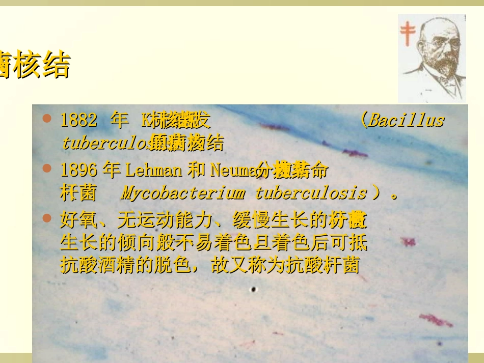 社区结核病防治知识_第3页