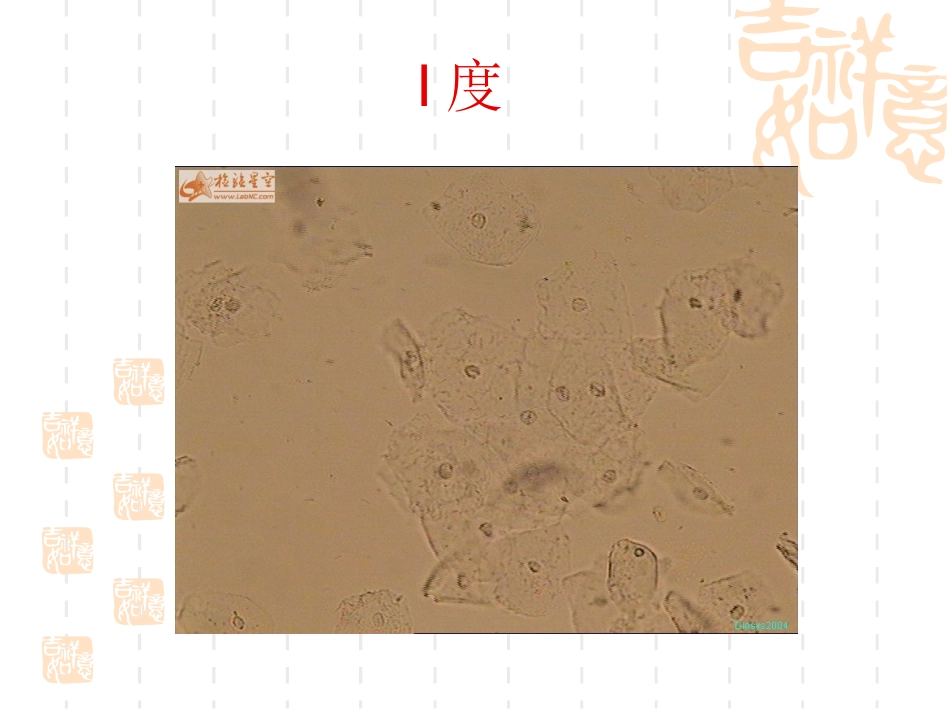 白带盐水涂片镜下图谱_第3页