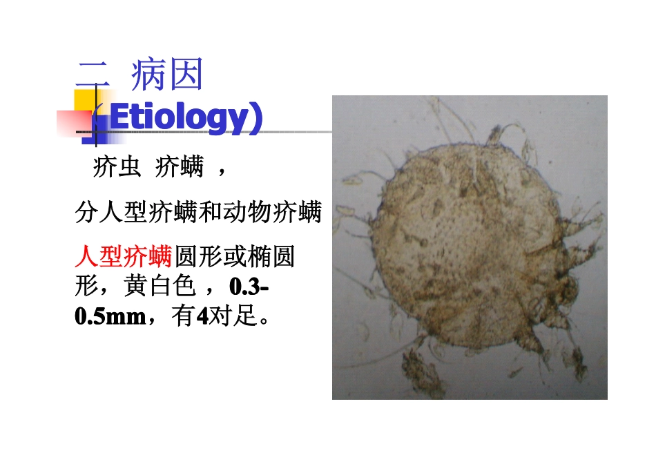 疥疮怎么可以治愈_第3页