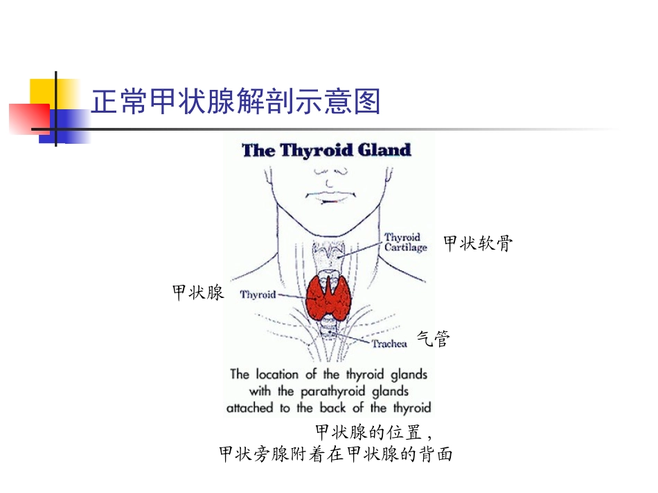 甲状腺功能亢进症PPT_第3页