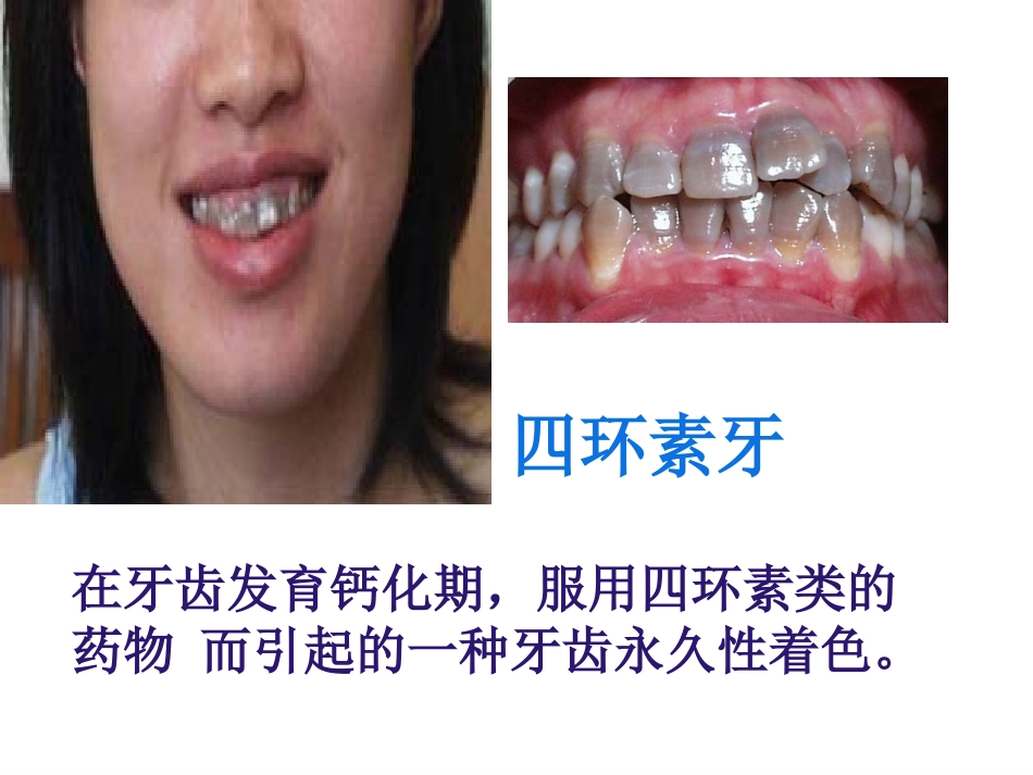 用药和急救分析_第3页