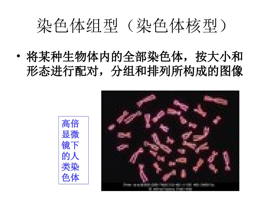 生物：2.3《性染色体与伴性遗传》课件(浙科版必修2)_第3页