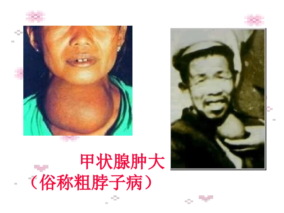 人教版九年级化学第十二单元课题2《化学元素与人体健康》PPT课件_第1页