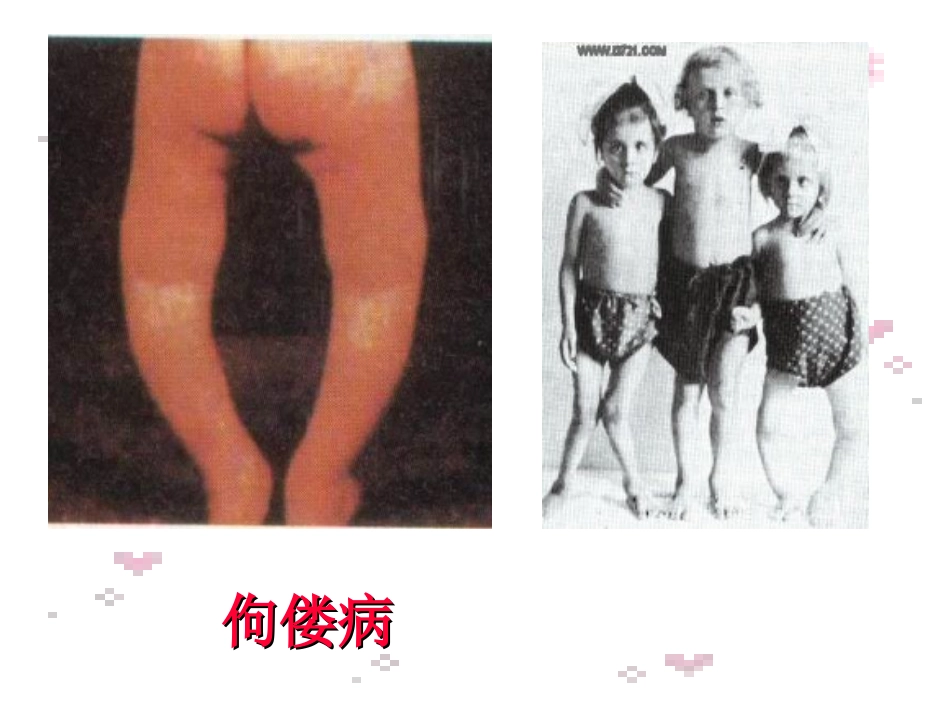 人教版九年级化学第十二单元课题2《化学元素与人体健康》PPT课件_第2页