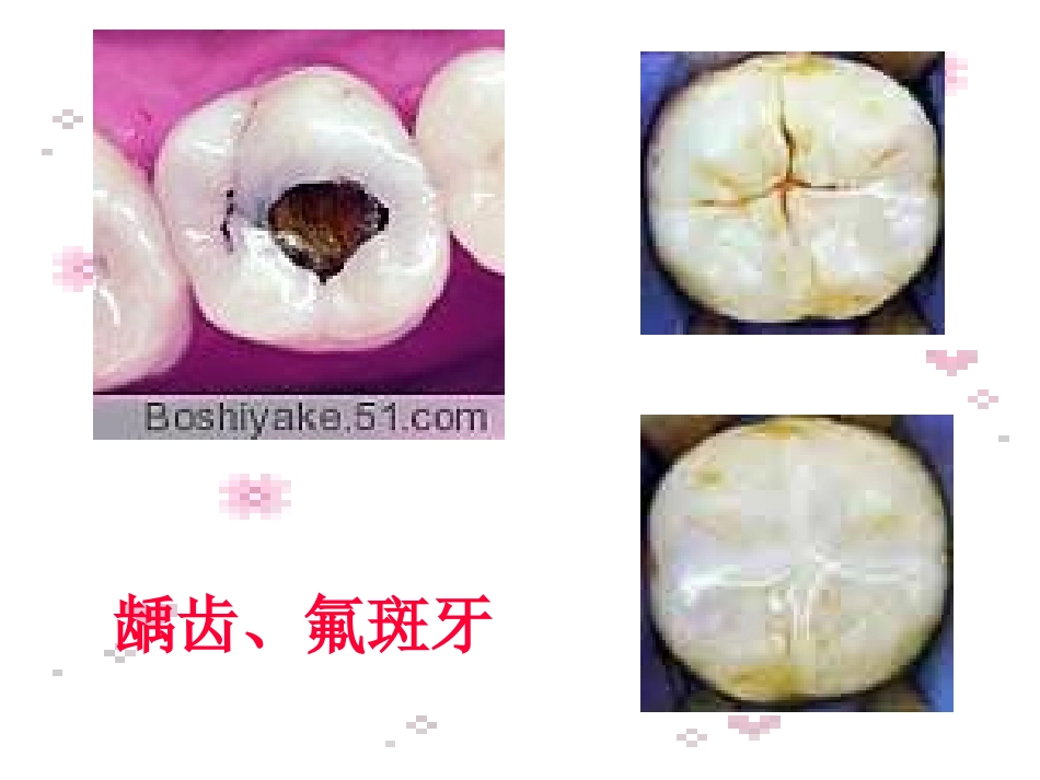 人教版九年级化学第十二单元课题2《化学元素与人体健康》PPT课件_第3页