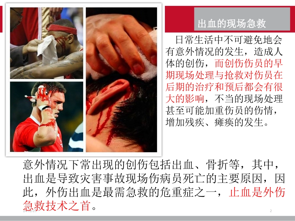 现场急救之出血_第2页