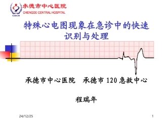特殊心电图现象在急诊中的快速识别与处理.