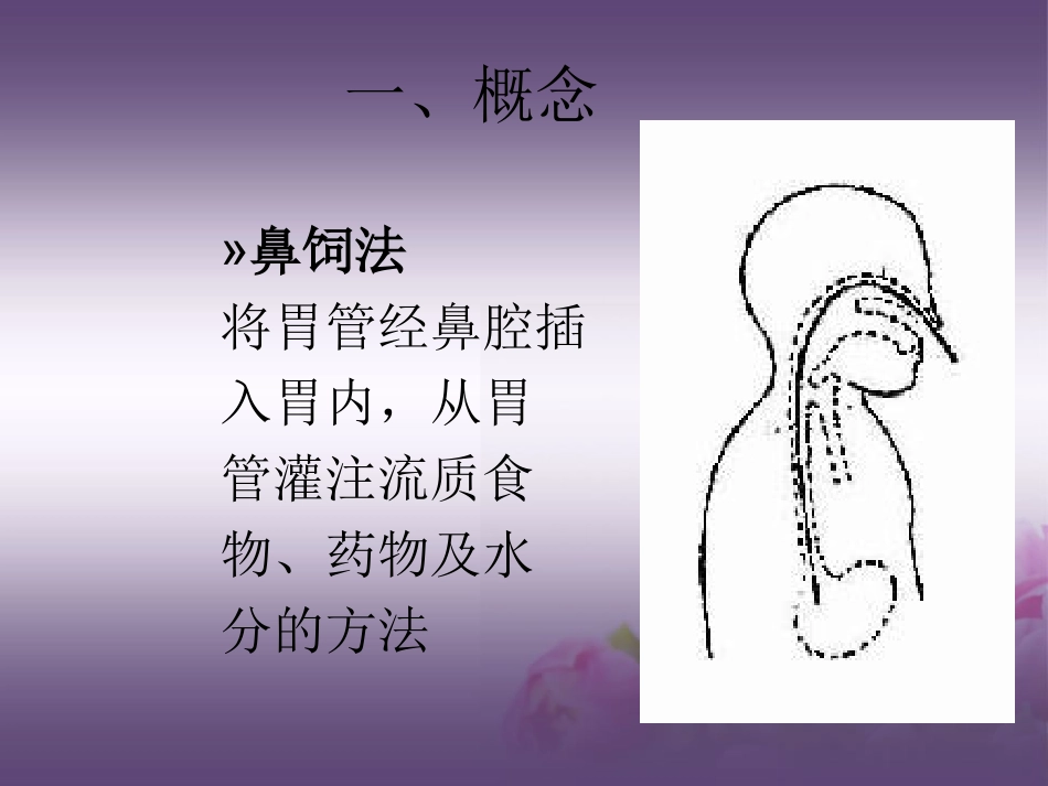 版鼻饲法操作PPT_第3页