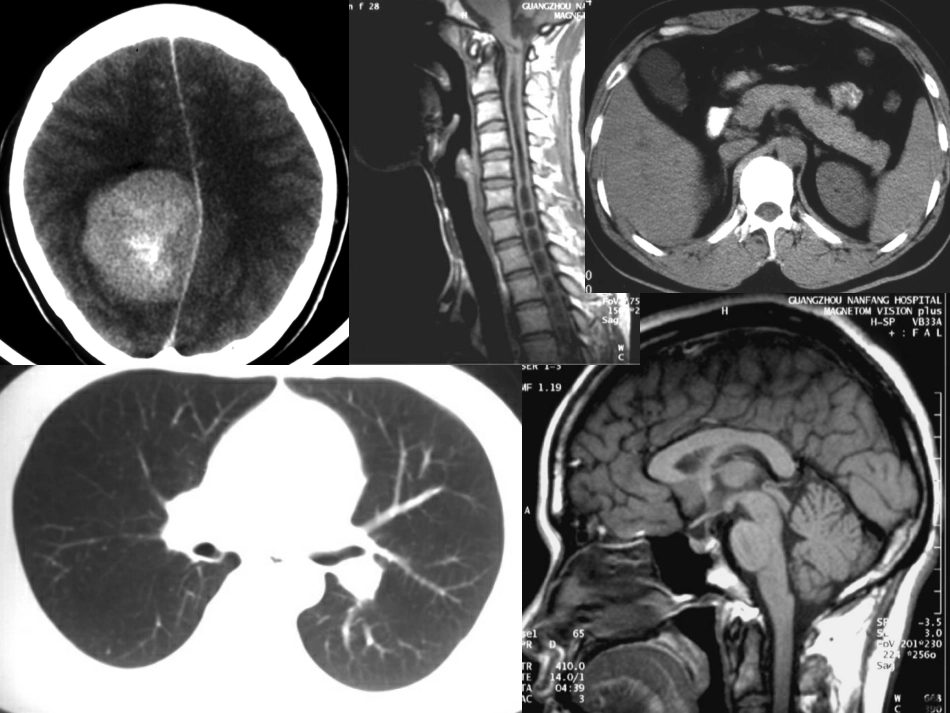 爱爱医资源-CT总论_第2页