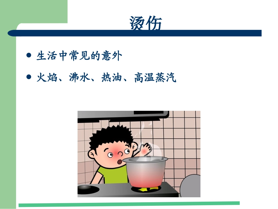 烫伤了-怎么办_第3页
