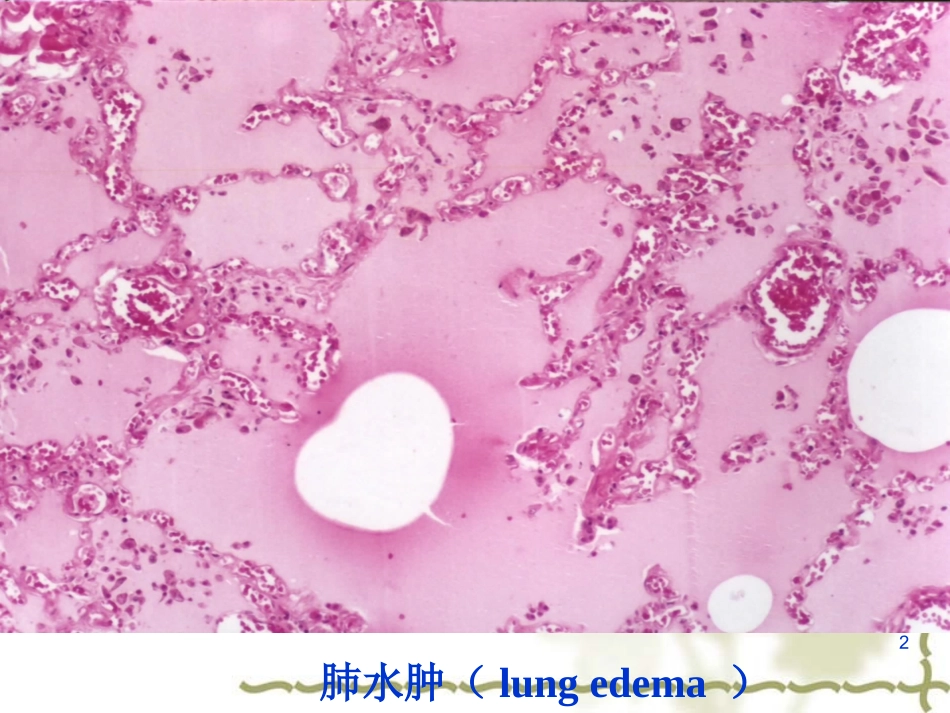 炎-症-2011张磊_第2页