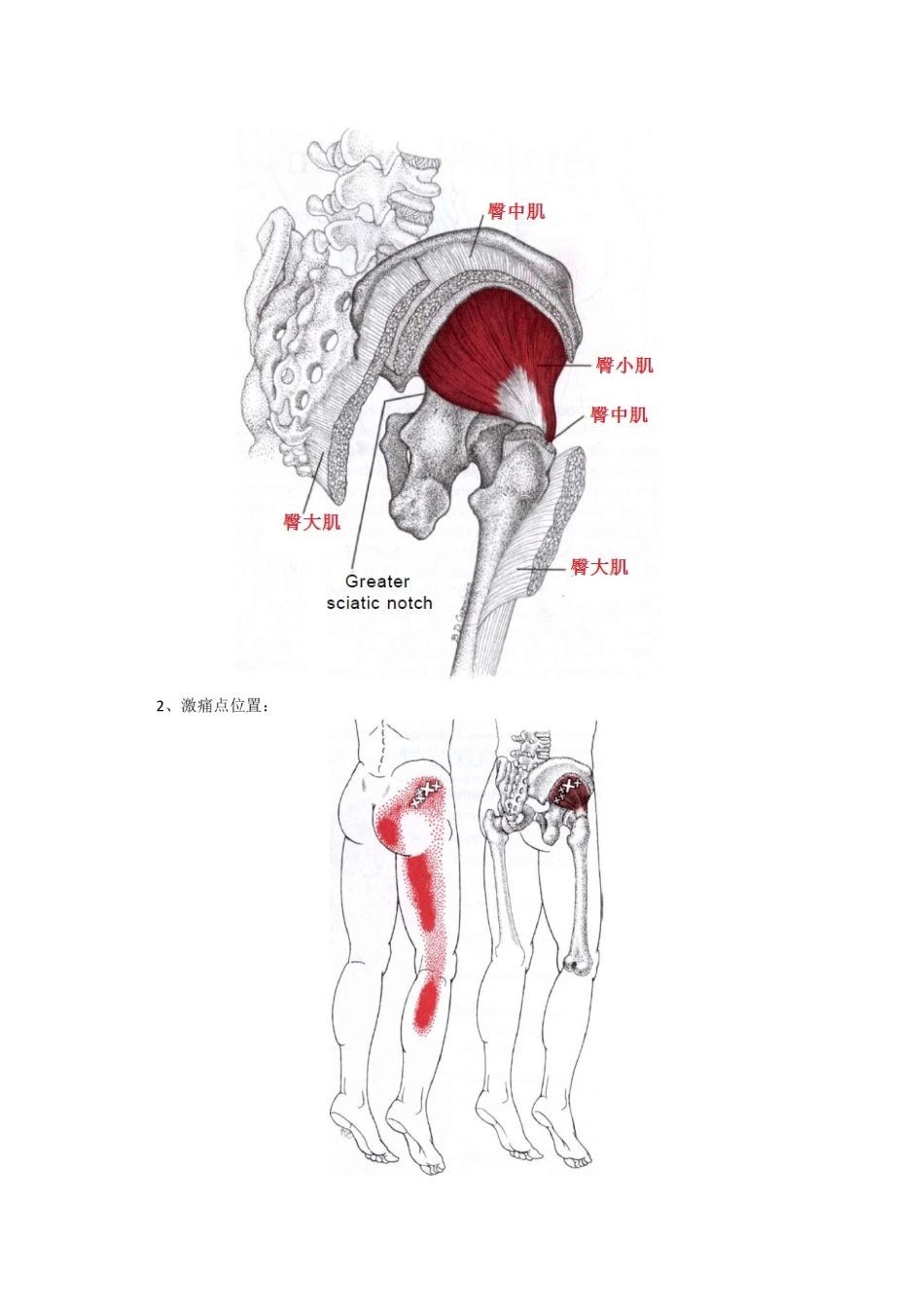 激痛点和肌肉疼痛自我按摩治疗(32)大腿后部痛_第2页
